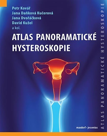 Levně Atlas panoramatické hysteroskopie - Petr Kovář