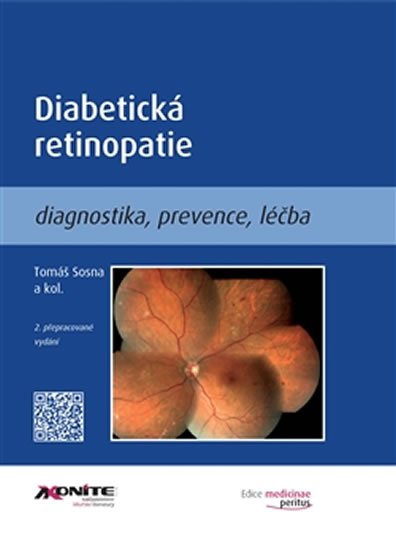 Levně Diabetická retinopatie - Diagnostika, prevence, léčba - Tomáš Sosna