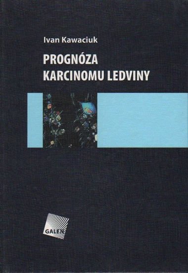 Levně Prognóza karcinomu ledviny - Ivan Kawaciuk