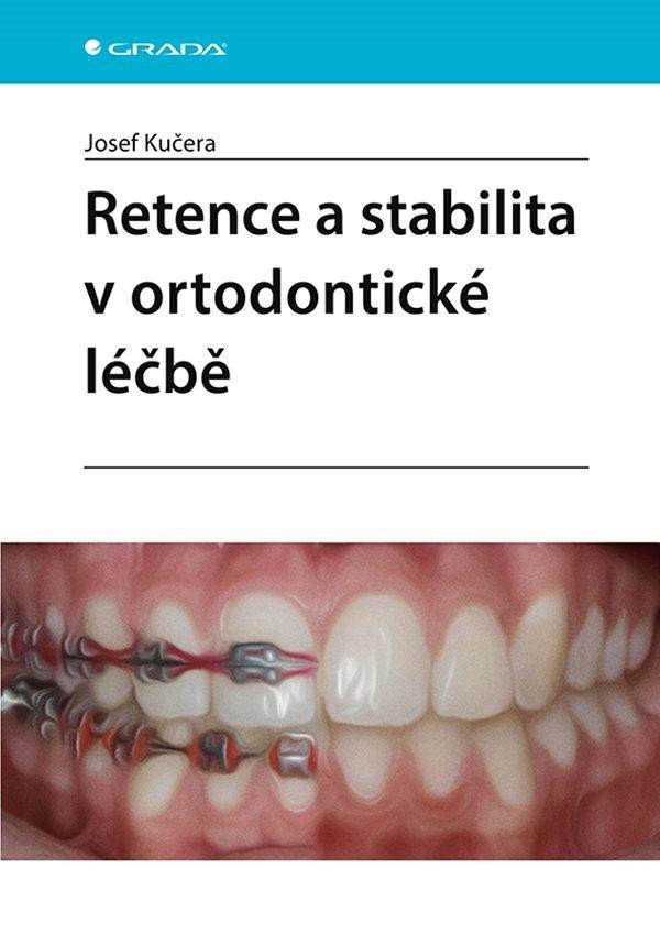 Levně Retence a stabilita v ortodontické léčbě - Josef Kučera