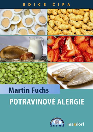 Levně Potravinové alergie - Martin Fuchs