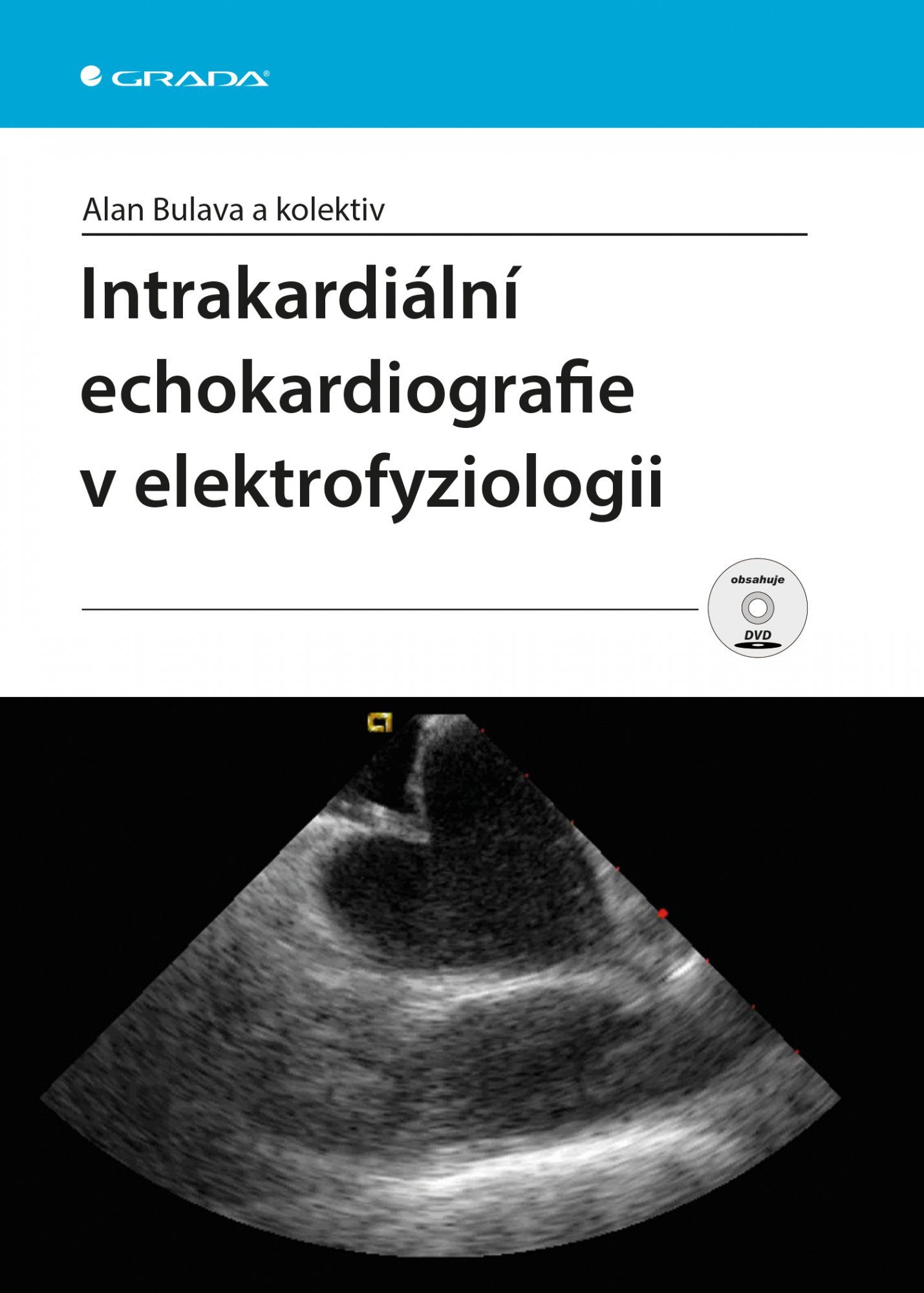 Levně Intrakardiální echokardiografie v elektrofyziologii + DVD - Alan Bulava