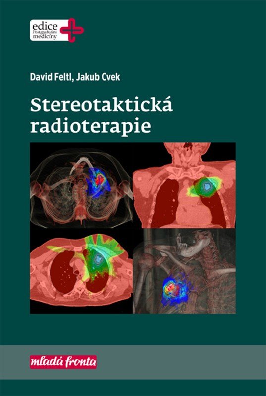 Levně Stereotaktická radioterapie - Jakub Cvek