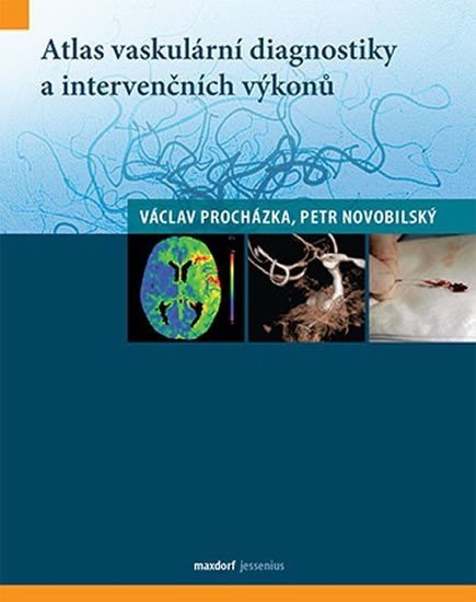 Atlas vaskulární diagnostiky a intervenčních výkonů - Petr Novobilský