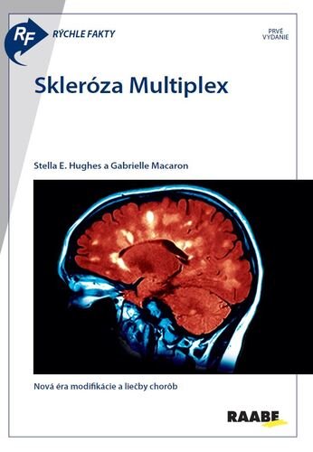 Levně Skleróza Multiplex - Gabrielle Macaron; Stella E. Hughes
