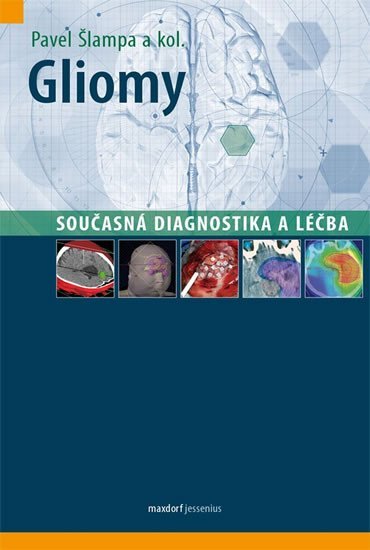 Gliomy - Současná diagnostika a léčba, 1. vydání - Pavel Šlampa