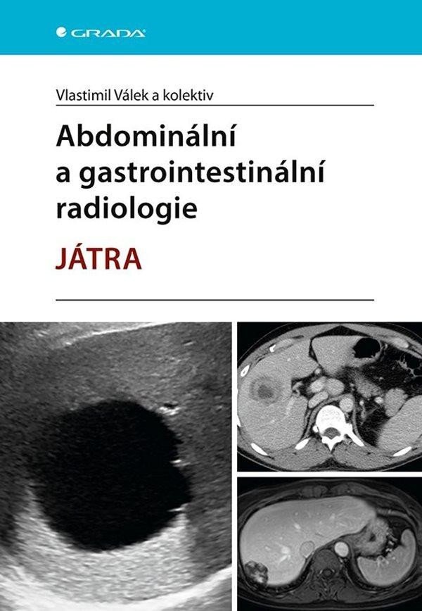 Levně Abdominální a gastrointestinální radiologie - Játra - Vlastimil Válek