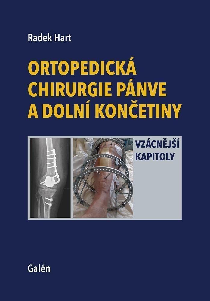 Levně Ortopedická chirurgie pánve a dolní končetiny - Vzácnější kapitoly - Radek Hart