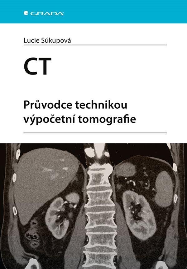 Levně CT - Průvodce technikou výpočetní tomografie - Lucie Súkupová