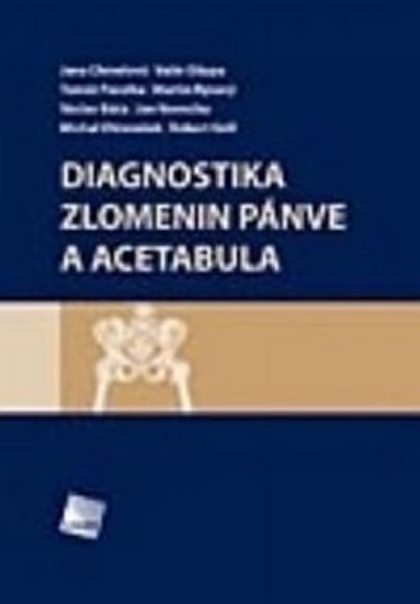 Levně Diagnostika zlomenin pánve a acetabula - Jan Vavrečka