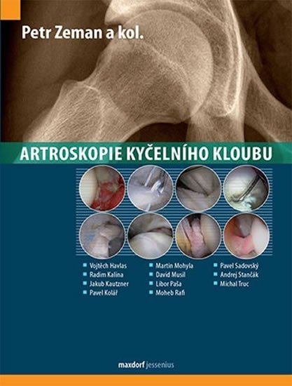 Levně Artroskopie kyčelního kloubu - Petr Zeman