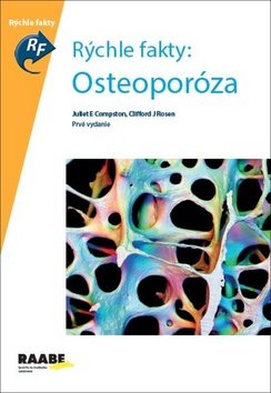 Levně Rýchle fakty: Osteoporóza - Juliet Compston; Clifford Rosen