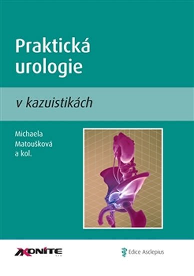 Praktická urologie v kazuistikách - Michaela Matoušková
