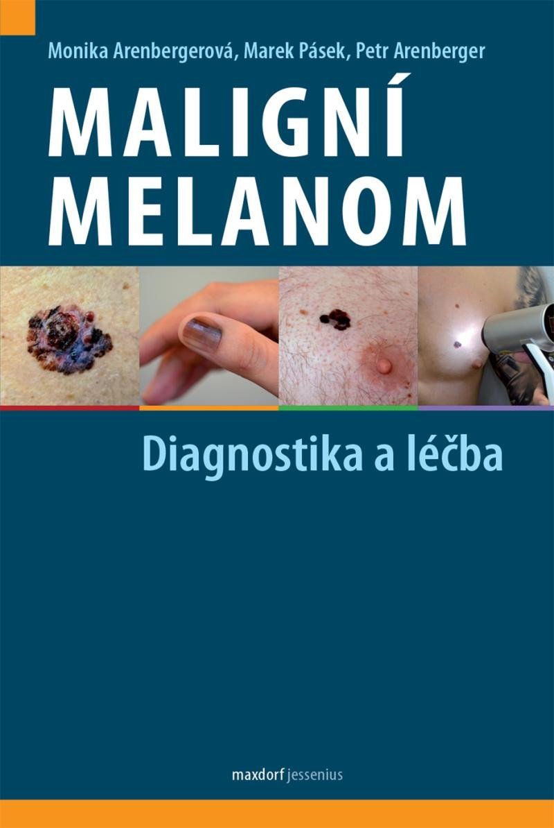 Levně Maligní melanom - Diagnostika a léčba - Monika Arenbergerová