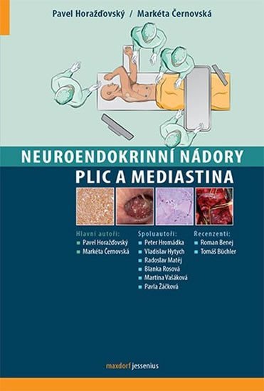Levně Neuroendokrinní nádory plic a mediastina - Markéta Černovská