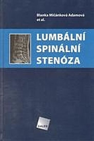 Levně Lumbální spinální stenóza - Adamová Blanka Mičánková