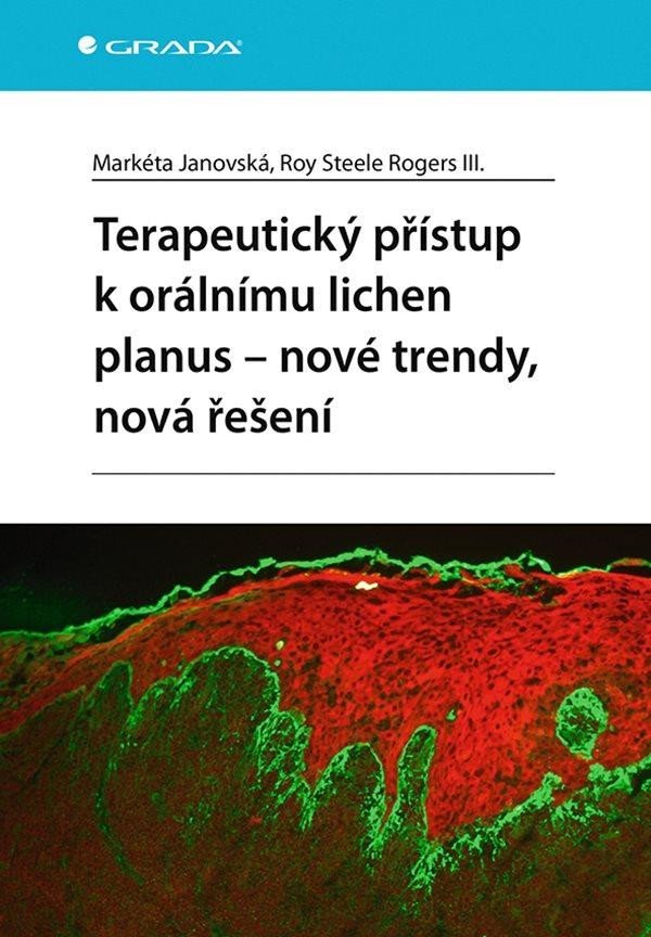 Levně Terapeutický přístup k orálnímu lichen planus - nové trendy, nová řešení - Markéta Janovská