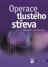 Levně Operace tlustého střeva - Jan Šváb