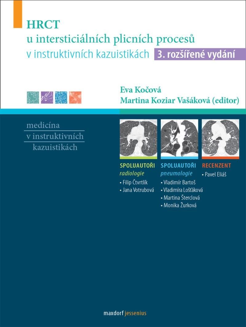 HRCT u intersticiálních plicních procesů v instruktivních kazuistikách, 3. vydání - Eva Kočová