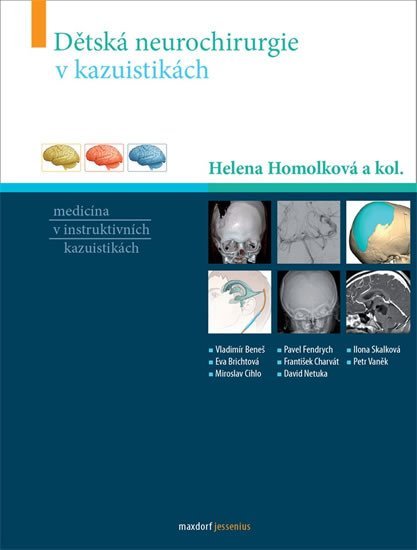 Levně Dětská neurochirurgie v kazuistikách - Homolková Helena a kolektiv