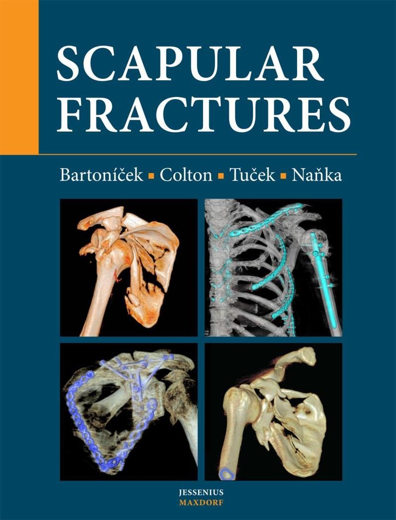 Scapular fractures - Ondřej Naňka