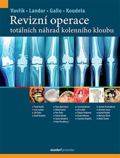 Revizní operace totálních náhrad kolenního kloubu - Pavel Vavřík; Jiří Gallo; Ivan Landor