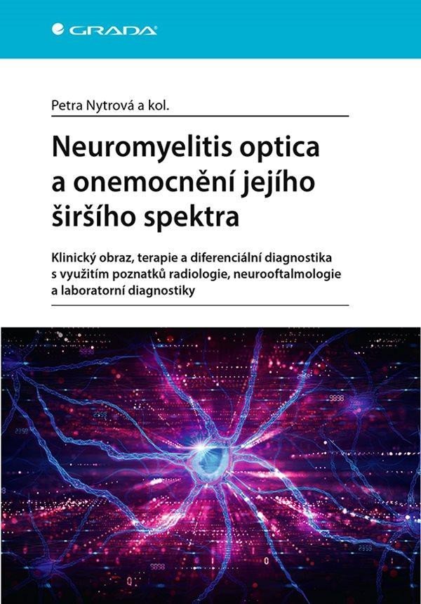 Levně Neuromyelitis optica a poruchy jejího širšího spektra - Petra Nytrová