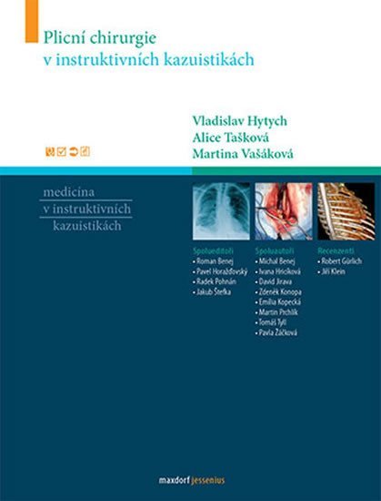 Levně Plicní chirurgie v instruktivních kazuistikách - kolektiv autorů