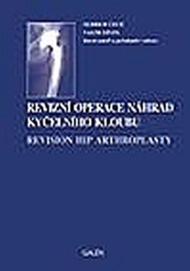 Revizní operace náhrad kyčelního kloubu - Martin Krbec