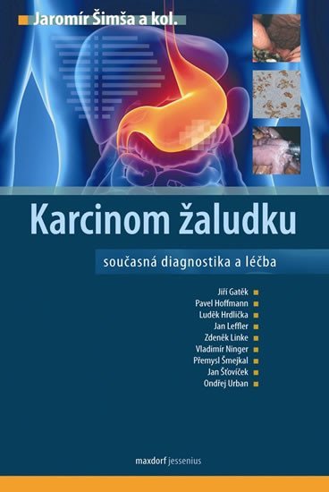 Levně Karcinom žaludku - Jaromír Šimša