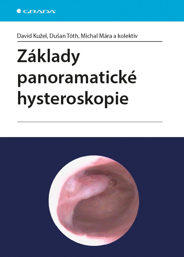 Základy panoramatické hysteroskopie - David Kužel; Dušan Tóth; Michal Mára