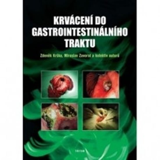 Levně Krvácení do gastrointestinálního traktu - Zdeněk Krška