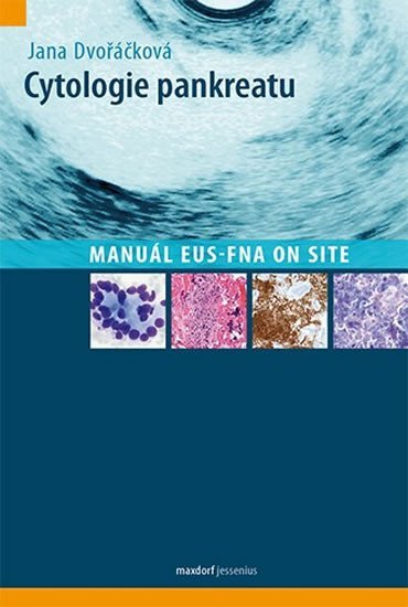 Levně Cytologie pankreatu - Manuál EUS-FNA on site - Jana Dvořáčková