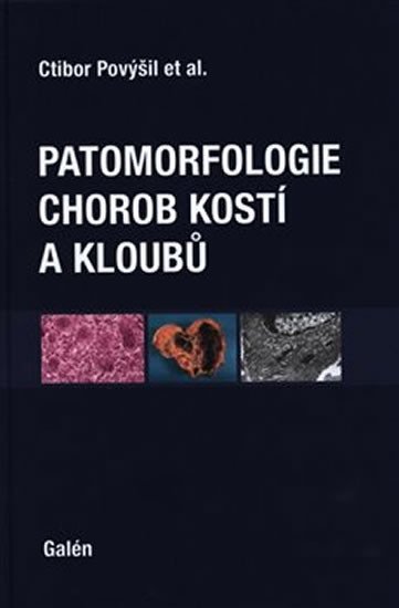 Levně Patomorfologie chorob kostí a kloubů - Ctibor Povýšil