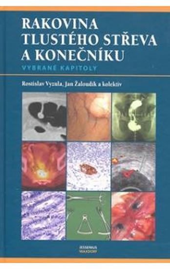 Levně Rakovina tlustého střeva a konečníku - vybrané kapitoly - Rostislav Vyzula