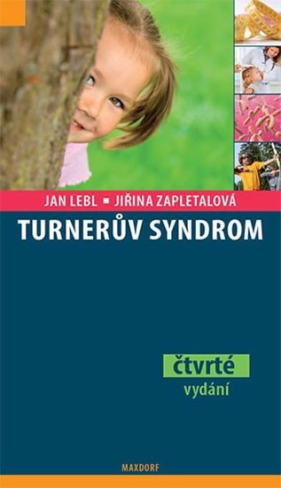 Levně Turnerův syndrom - Jan Lebl