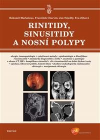 Levně Rinitidy, sinusitidy a nosní polypy - Bohumil Markalous