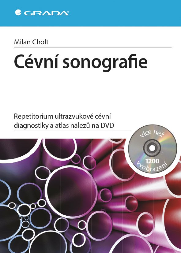 Cévní sonografie - repetitorium ultrazvukové cévní diagnostiky a atlas nálezů na DVD - Milan Cholt