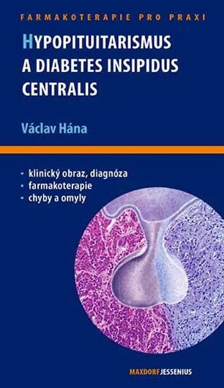 Levně Hypopituitarismus a diabetes insipidus centralis - Václav Hána