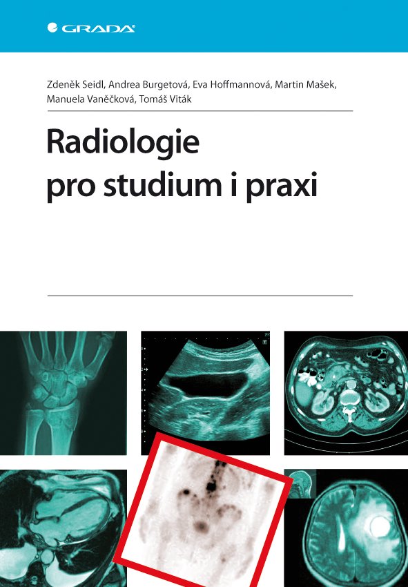 Levně Radiologie pro studium i praxi - Zdeněk Seidl
