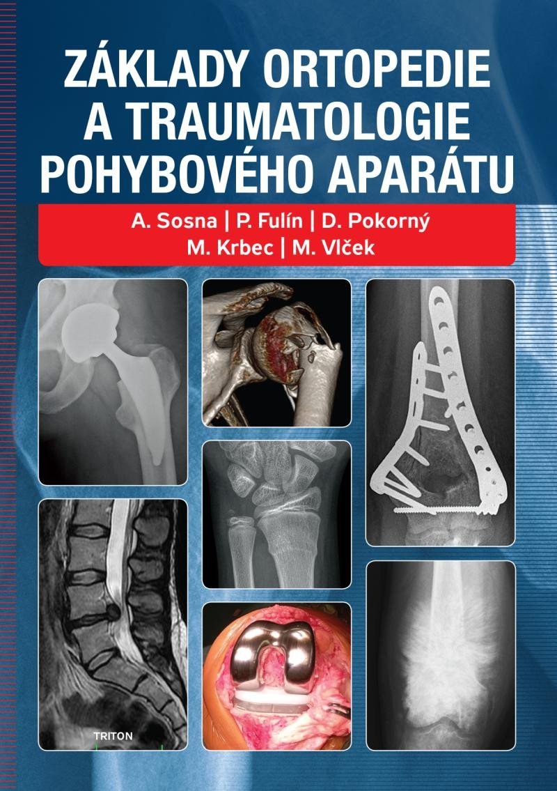 Levně Základy ortopedie a traumatologie pohybového aparátu - Antonín Sosna