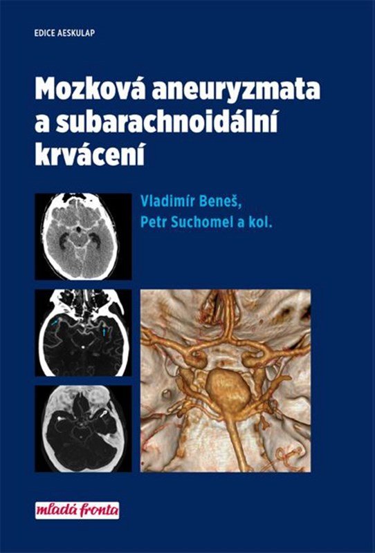 Levně Mozková aneurysmata a subarachnoidální krvácení - Vladimír Beneš