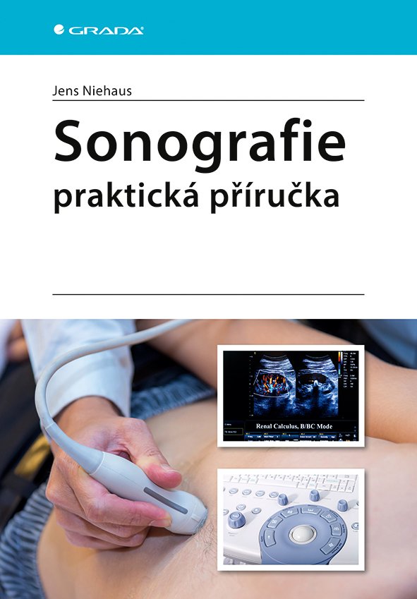 Sonografie - praktická příručka - Jens Niehaus