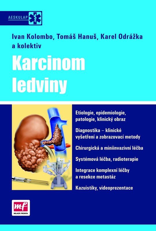 Levně Karcinom ledviny - kolektiv autorů