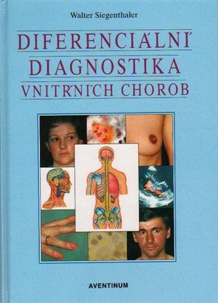 Diferenciální diagnostika vnitřních chorob - Walter Siegenthaler