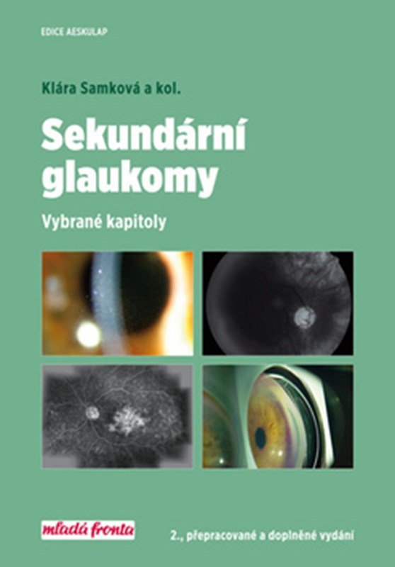 Levně Sekundární glaukomy - Vybrané kapitoly, 2. vydání - Klára Samková