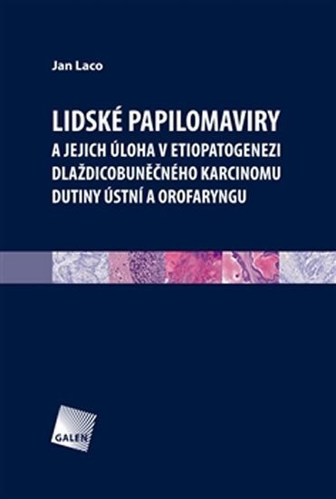 Levně Lidské papilomaviry - Jan Laco