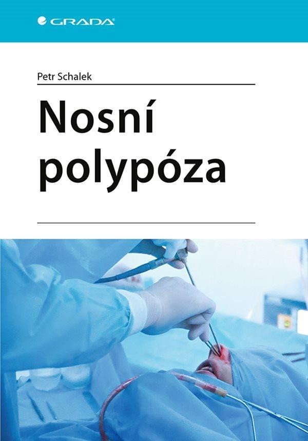 Levně Nosní polypóza - Petr Schalek