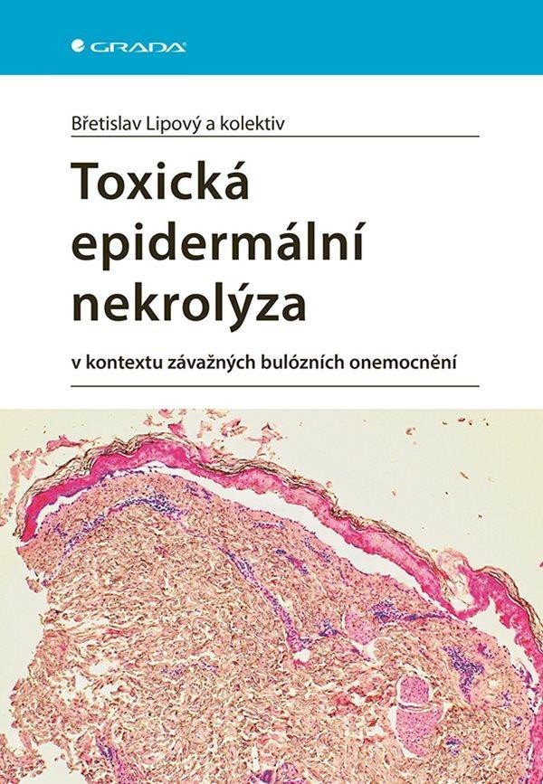 Product detail of Toxická epidermální nekrolýza v kontextu závažných bulózních onemocnění - Břetislav Lipový