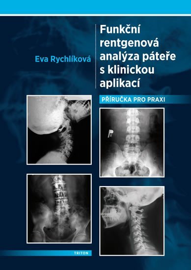 Levně Funkční rentgenová analýza páteře s klinickou aplikací - Eva Rychlíková